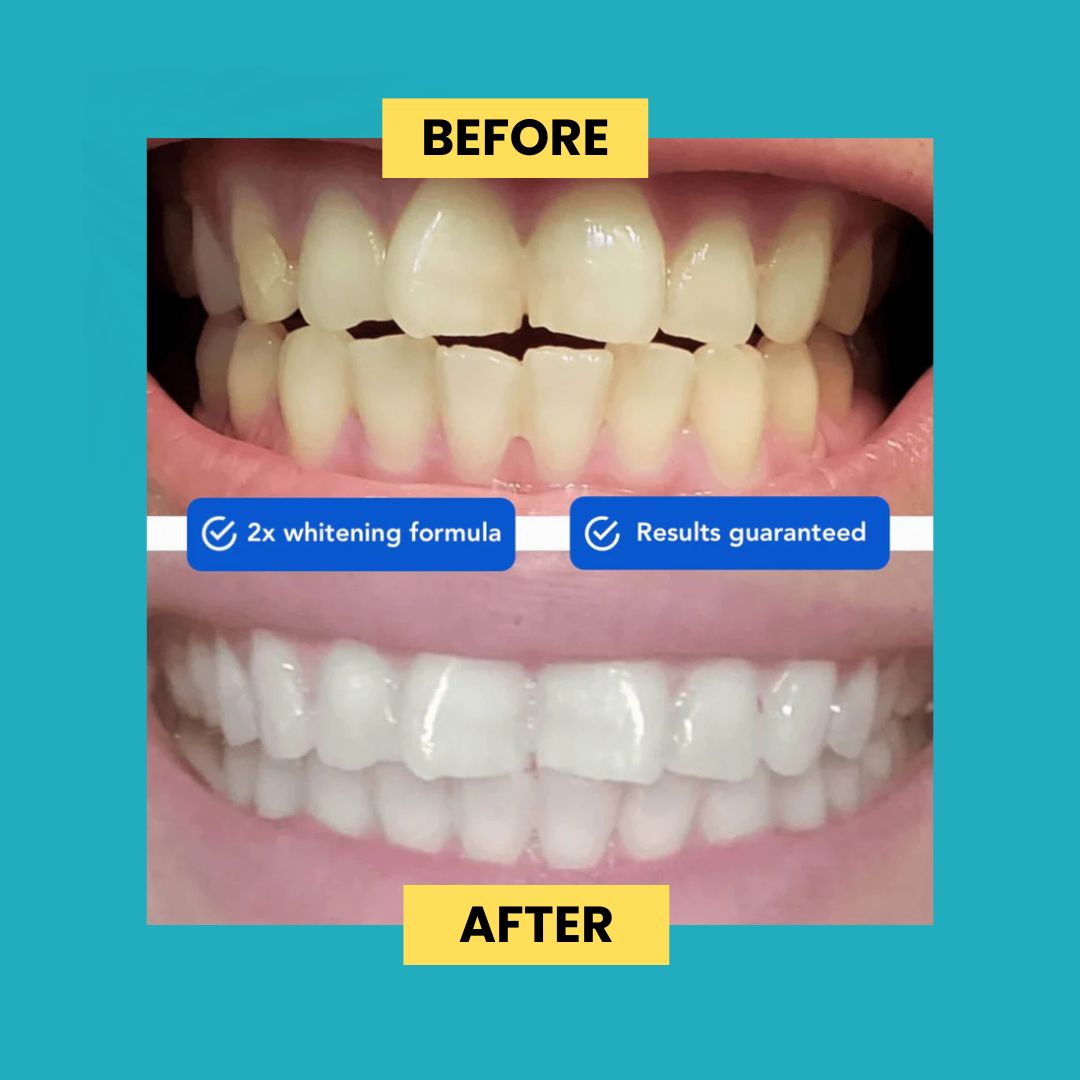 NextBuy™️ Guru Nanda Coconut Oil Pulling with Essential Oils