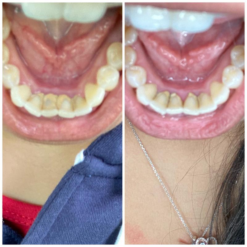 NextBuy™️ Guru Nanda Coconut Oil Pulling with Essential Oils