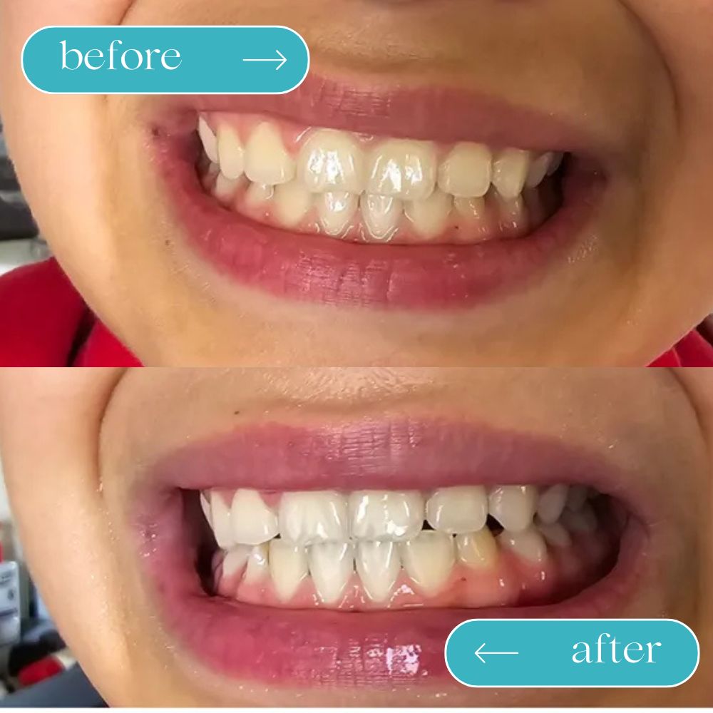 NextBuy™️ Guru Nanda Coconut Oil Pulling with Essential Oils