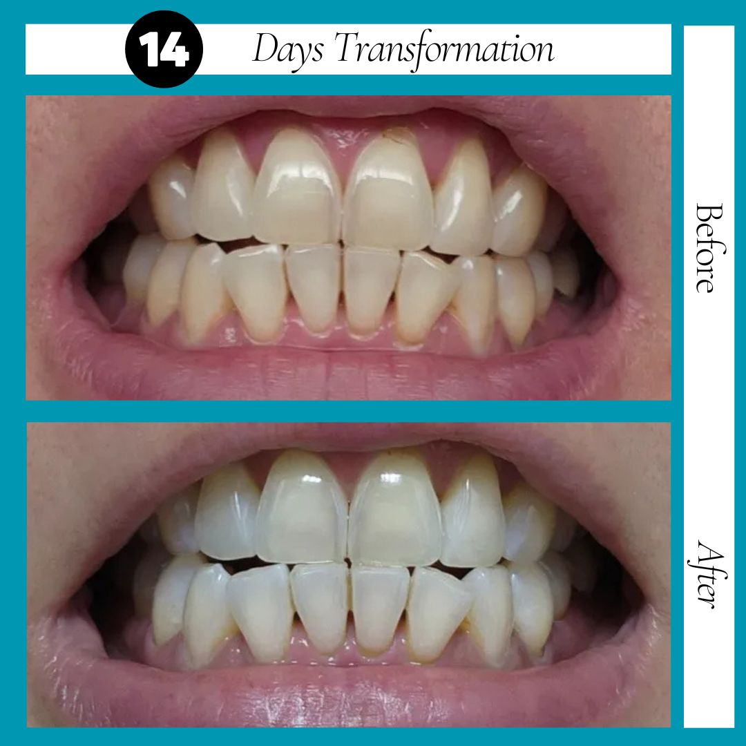 NextBuy™️ Guru Nanda Coconut Oil Pulling with Essential Oils