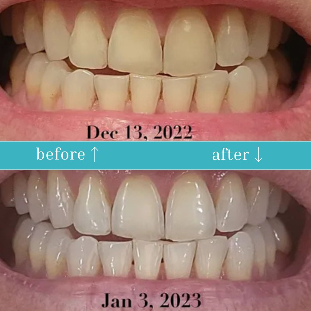 NextBuy™️ Guru Nanda Coconut Oil Pulling with Essential Oils