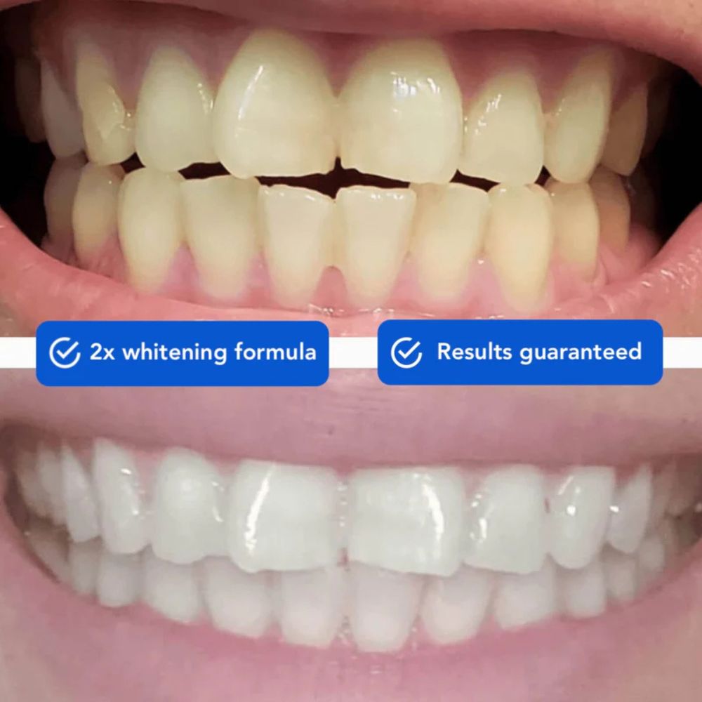 NextBuy™️ Guru Nanda Coconut Oil Pulling with Essential Oils